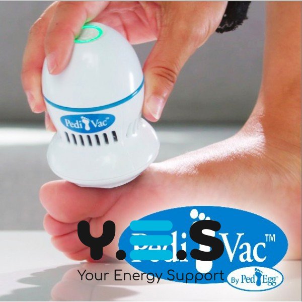 Електропемза для ніг Find Back Pedi Vac — машинка для педикюру, видалення натоптишів